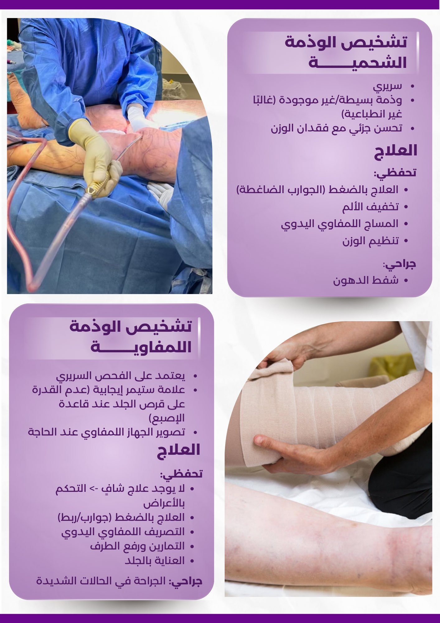 Lipedema vs Lymphedema 4