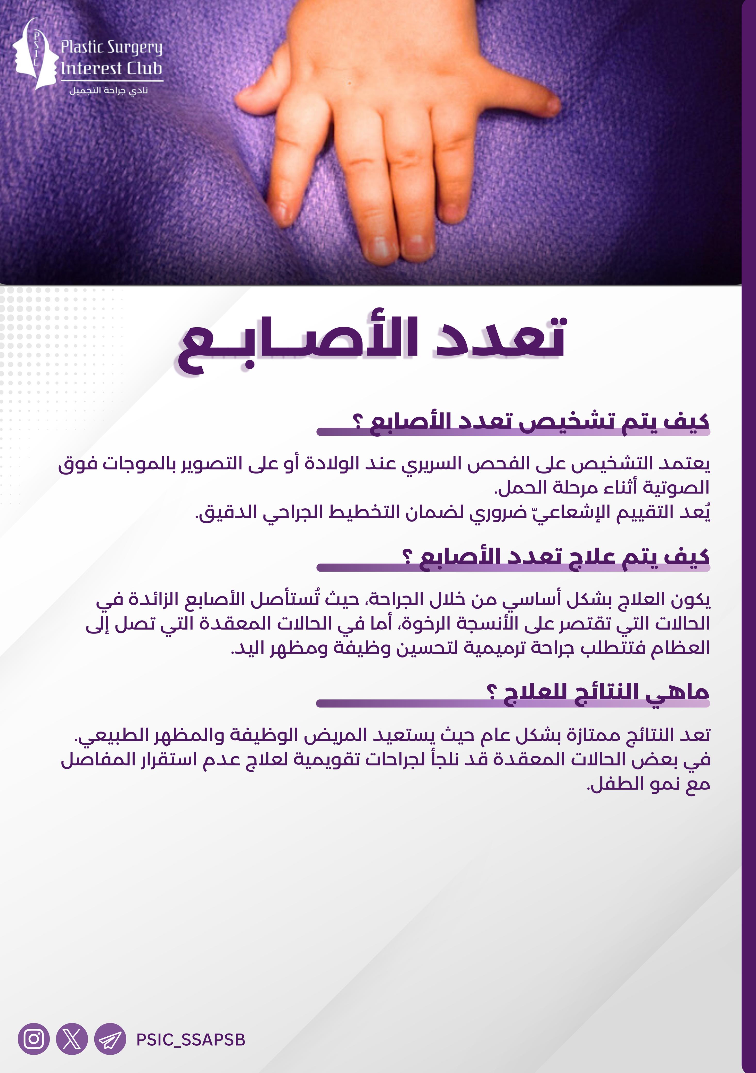 Polydactyly of Fingers 2